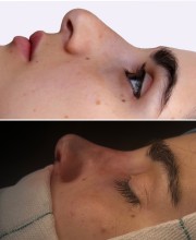 رینو پلاستی